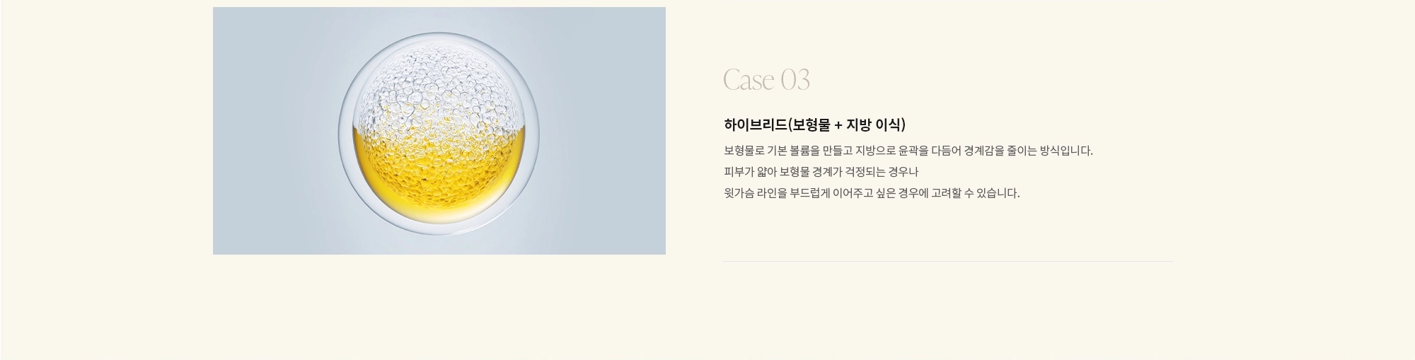 [Case 03] 하이브리드(보형물 + 지방 이식) :  보형물로 기본 볼륨을 만들고 지방으로 윤곽을 다듬어 경계감을 줄이는 방식입니다. 피부가 얇아 보형물 경계가 걱정되는 경우나 윗가슴 라인을 부드럽게 이어주고 싶은 경우에 고려할 수 있습니다.