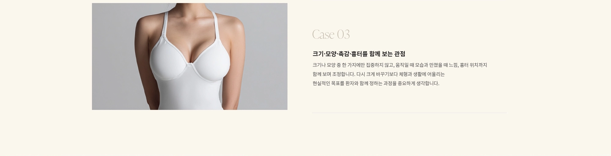 [Case 03] 크기·모양·촉감·흉터를 함께 보는 관점 : 크기나 모양 중 한 가지에만 집중하지 않고, 움직일 때 모습과 만졌을 때 느낌, 흉터 위치까지 함께 보며 조정합니다. 다시 크게 바꾸기보다 체형과 생활에 어울리는 현실적인 목표를 환자와 함께 정하는 과정을 중요하게 생각합니다.