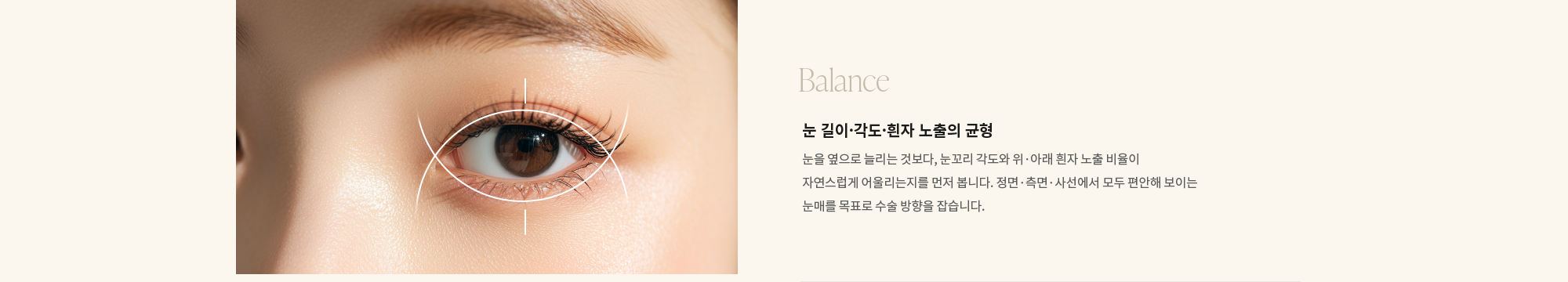 [Balance] 눈 길이·각도·흰자 노출의 균형 : 눈을 옆으로 늘리는 것보다, 눈꼬리 각도와 위·아래 흰자 노출 비율이 자연스럽게 어울리는지를 먼저 봅니다. 정면·측면·사선에서 모두 편안해 보이는 눈매를 목표로 수술 방향을 잡습니다.