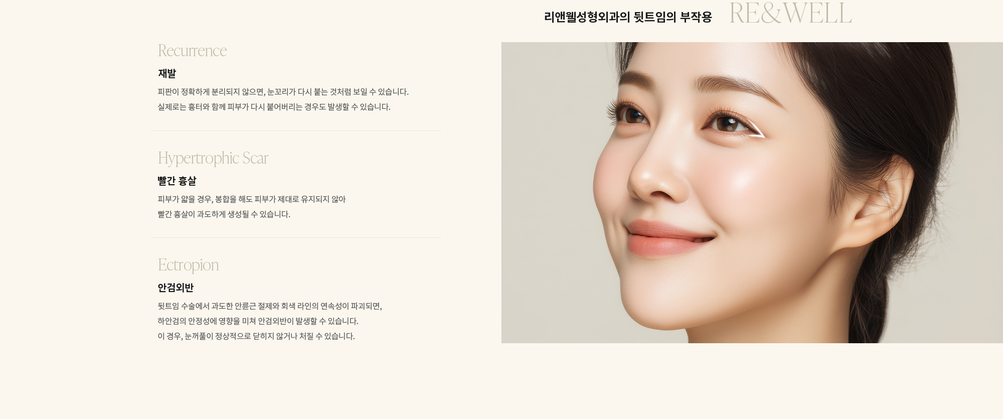 [리앤웰성형외과의 뒷트임의 부작용] {Recurrence 재발} 피판이 정확하게 분리되지 않으면, 눈꼬리가 다시 붙는 것처럼 보일 수 있습니다. 실제로는 흉터와 함께 피부가 다시 붙어버리는 경우도 발생할 수 있습니다. / {Hypertrophic Scar 빨간 흉살} 피부가 얇을 경우, 봉합을 해도 피부가 제대로 유지되지 않아 빨간 흉살이 과도하게 생성될 수 있습니다. / {Ectropion 안검외반} 뒷트임 수술에서 과도한 안륜근 절제와 회색 라인의 연속성이 파괴되면, 하안검의 안정성에 영향을 미쳐 안검외반이 발생할 수 있습니다. 이 경우, 눈꺼풀이 정상적으로 닫히지 않거나 처질 수 있습니다.
