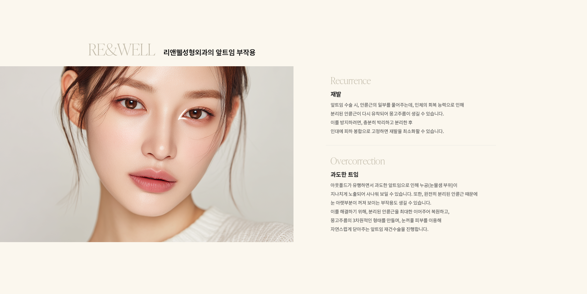 [리앤웰성형외과의 앞트임 부작용] {Recurrence 재발} 앞트임 수술 시, 안륜근의 일부를 풀어주는데, 인체의 회복 능력으로 인해 분리된 안륜근이 다시 유착되어 몽고주름이 생길 수 있습니다. 이를 방지하려면, 충분히 박리하고 분리한 후 인대에 피하 봉합으로 고정하면 재발을 최소화할 수 있습니다. / {Overcorrection 과도한 트임} 아웃폴드가 유행하면서 과도한 앞트임으로 인해 누공(눈물샘 부위)이 지나치게 노출되어 사나워 보일 수 있습니다. 또한, 완전히 분리된 안륜근 때문에 눈 아랫부분이 꺼져 보이는 부작용도 생길 수 있습니다. 이를 해결하기 위해, 분리된 안륜근을 최대한 이어주어 복원하고, 몽고주름의 3차원적인 형태를 만들며, 눈꺼풀 피부를 이용해 자연스럽게 닫아주는 앞트임 재건수술을 진행합니다.