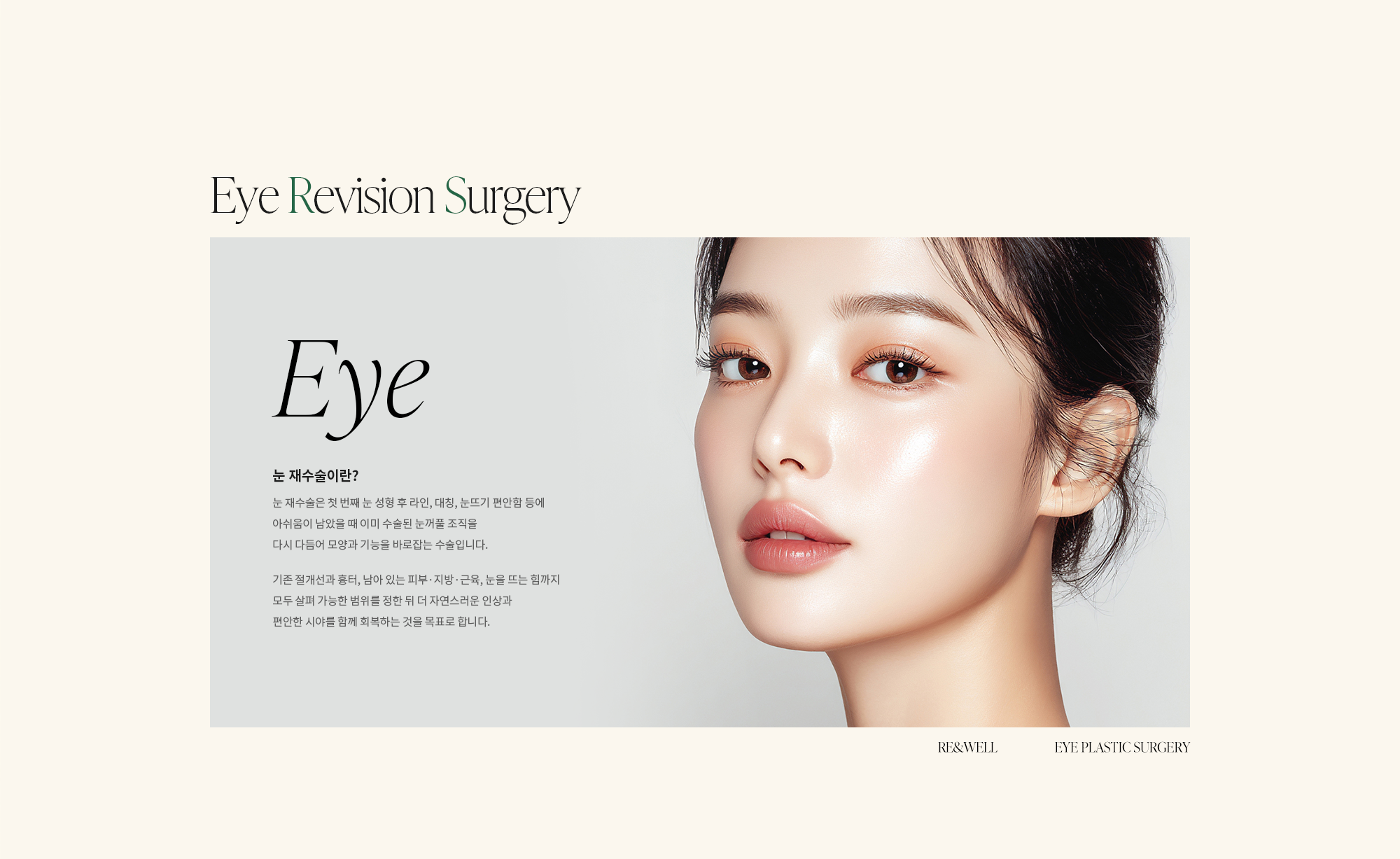 [눈 재수술이란?] 눈 재수술은 첫 번째 눈 성형 후 라인, 대칭, 눈뜨기 편안함 등에 아쉬움이 남았을 때 이미 수술된 눈꺼풀 조직을 다시 다듬어 모양과 기능을 바로잡는 수술입니다. 기존 절개선과 흉터, 남아 있는 피부·지방·근육, 눈을 뜨는 힘까지 모두 살펴 가능한 범위를 정한 뒤 더 자연스러운 인상과 편안한 시야를 함께 회복하는 것을 목표로 합니다.
