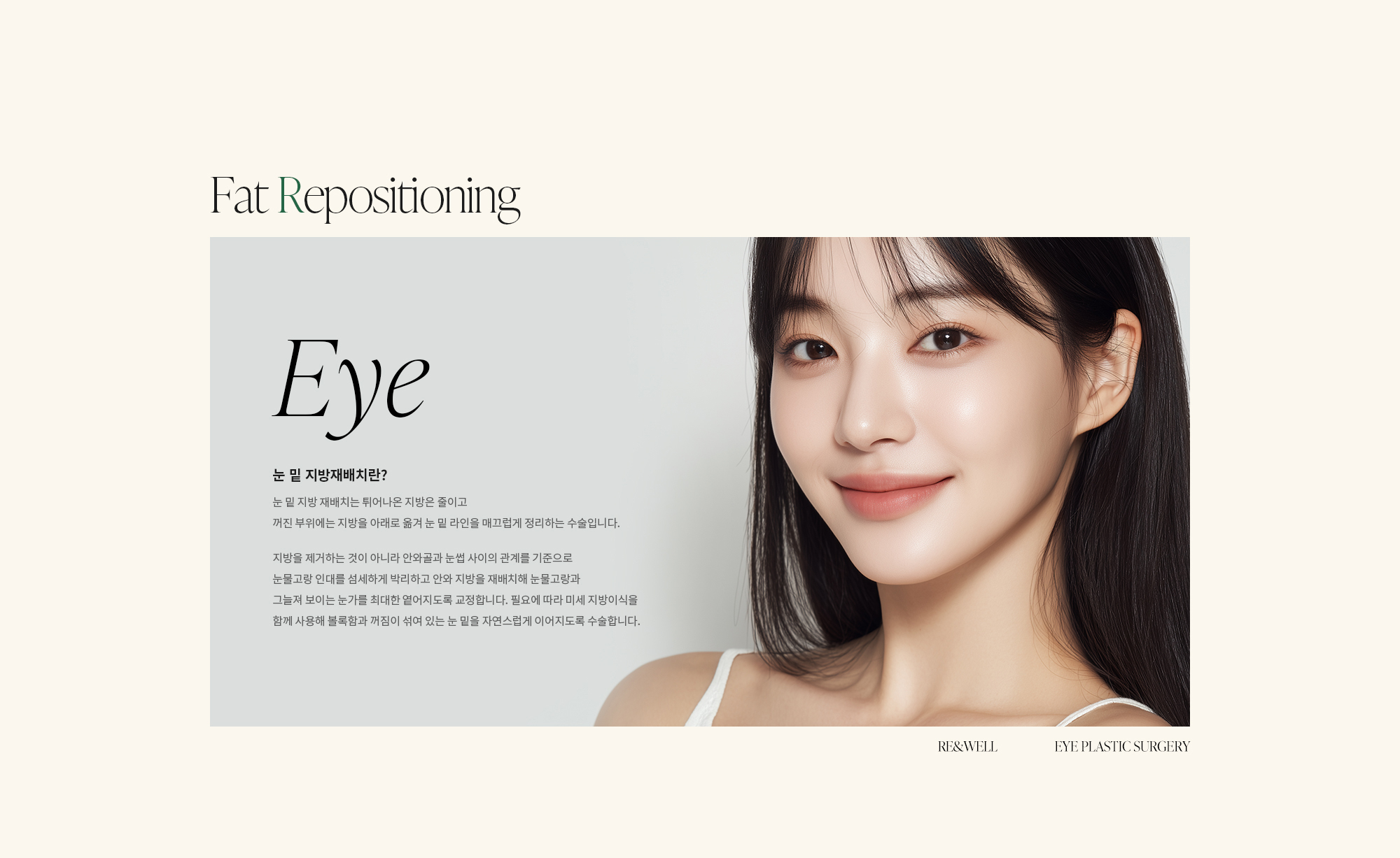 [꺼진 눈성형 이란?] 눈 밑 지방 재배치는 튀어나온 지방은 줄이고 꺼진 부위에는 지방을 아래로 옮겨 눈 밑 라인을 매끄럽게 정리하는 수술입니다. 지방을 제거하는 것이 아니라 안와골과 눈썹 사이의 관계를 기준으로 눈물고랑 인대를 섬세하게 박리하고 안와 지방을 재배치해 눈물고랑과 그늘져 보이는 눈가를 최대한 옅어지도록 교정합니다. 필요에 따라 미세 지방이식을 함께 사용해 볼록함과 꺼짐이 섞여 있는 눈 밑을 자연스럽게 이어지도록 수술합니다.