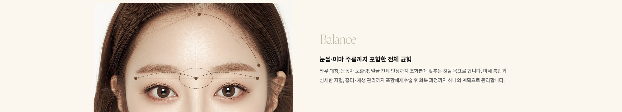 [Balance] 눈썹·이마 주름까지 포함한 전체 균형 : 좌우 대칭, 눈동자 노출량, 얼굴 전체 인상까지 조화롭게 맞추는 것을 목표로 합니다. 미세 봉합과 섬세한 지혈, 흉터·재생 관리까지 포함해재수술 후 회복 과정까지 하나의 계획으로 관리합니다.