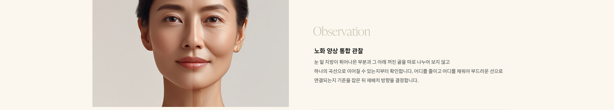 [Observation] 노화 양상 통합 관찰 : 눈 밑 지방이 튀어나온 부분과 그 아래 꺼진 골을 따로 나누어 보지 않고 하나의 곡선으로 이어질 수 있는지부터 확인합니다. 어디를 줄이고 어디를 채워야 부드러운 선으로 연결되는지 기준을 잡은 뒤 재배치 방향을 결정합니다.