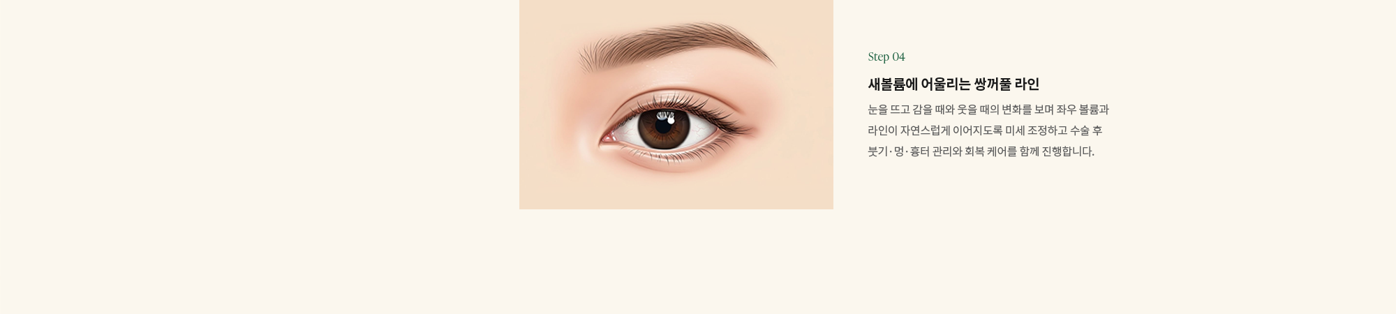 Step 04) 새볼륨에 어울리는 쌍꺼풀 라인 : 눈을 뜨고 감을 때와 웃을 때의 변화를 보며 좌우 볼륨과 라인이 자연스럽게 이어지도록 미세 조정하고 수술 후 붓기·멍·흉터 관리와 회복 케어를 함께 진행합니다.