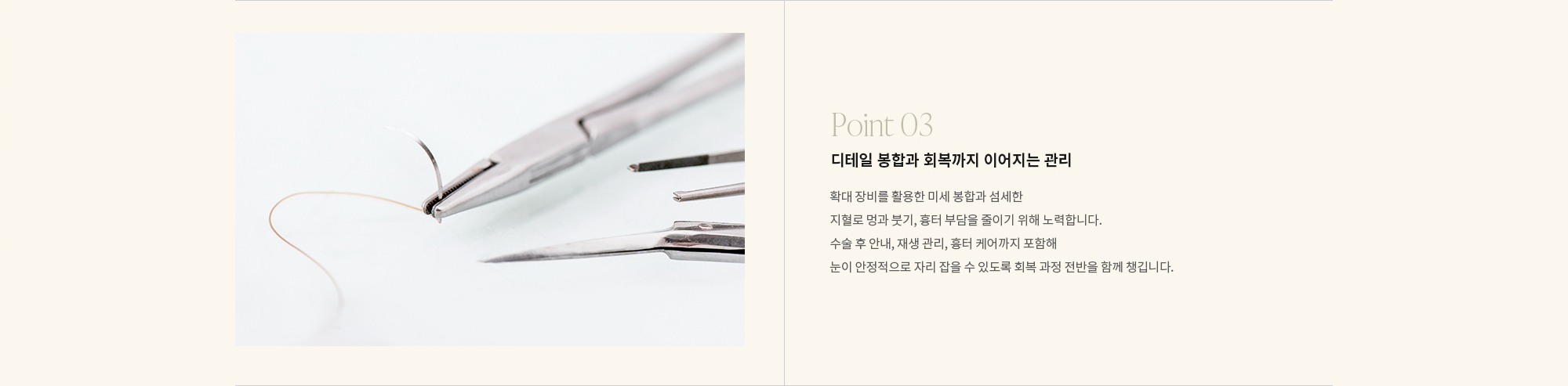 [Point 03] 디테일 봉합과 회복까지 이어지는 관리 : 확대 장비를 활용한 미세 봉합과 섬세한 지혈로 멍과 붓기, 흉터 부담을 줄이기 위해 노력합니다. 수술 후 안내, 재생 관리, 흉터 케어까지 포함해 눈이 안정적으로 자리 잡을 수 있도록 회복 과정 전반을 함께 챙깁니다.