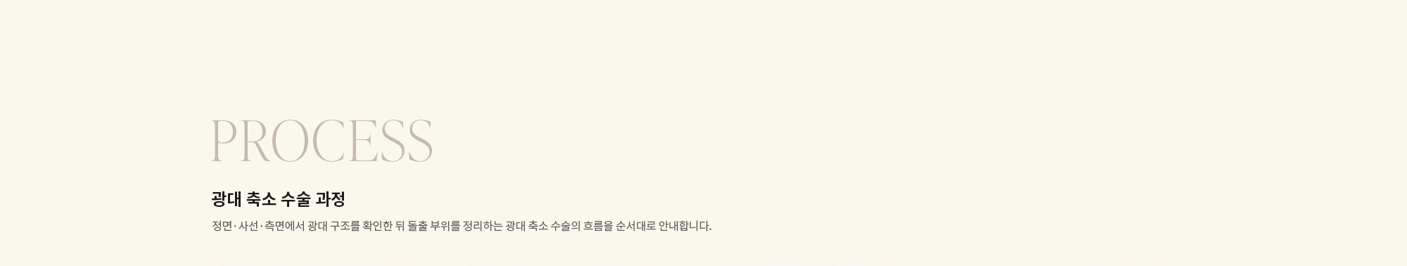 [PROCESS] 광대 축소 수술 과정 : 정면·사선·측면에서 광대 구조를 확인한 뒤 돌출 부위를 정리하는 광대 축소 수술의 흐름을 순서대로 안내합니다.
