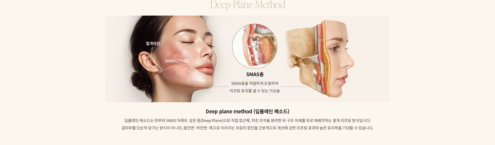 [Deep plane method (딥플레인 메소드)] 딥플레인 메소드는 피부와 SMAS 아래의  깊은 층(Deep Plane)으로 직접 접근해, 처진 조직을 분리한 뒤 구조 자체를 위로 재배치하는 절개 리프팅 방식입니다. 겉피부를 단순히 당기는 방식이 아니라, 중안면·하안면·목으로 이어지는 처짐의 원인을 근본적으로 개선해 강한 리프팅 효과와 높은 유지력을 기대할 수 있습니다.