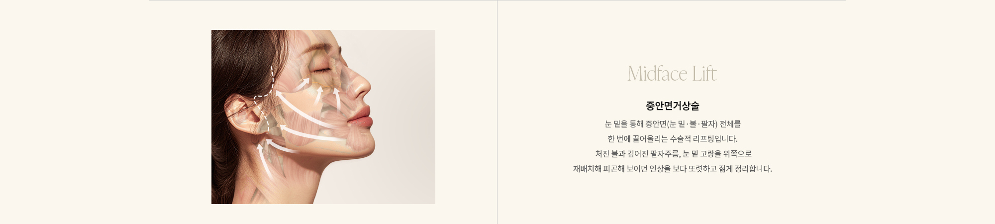 [중안면거상술 Midface Lift] 눈 밑을 통해 중안면(눈 밑·볼·팔자) 전체를 한 번에 끌어올리는 수술적 리프팅입니다.  처진 볼과 깊어진 팔자주름, 눈 밑 고랑을 위쪽으로 재배치해 피곤해 보이던 인상을 보다 또렷하고 젊게 정리합니다.