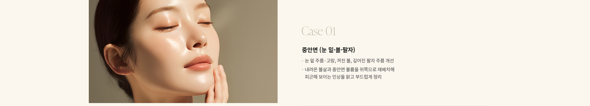 [Case 01] 중안면 (눈 밑·볼·팔자) : - 눈 밑 주름·고랑, 꺼진 볼, 깊어진 팔자 주름 개선 - 내려온 볼살과 중안면 볼륨을 위쪽으로 재배치해 피곤해 보이는 인상을 맑고 부드럽게 정리