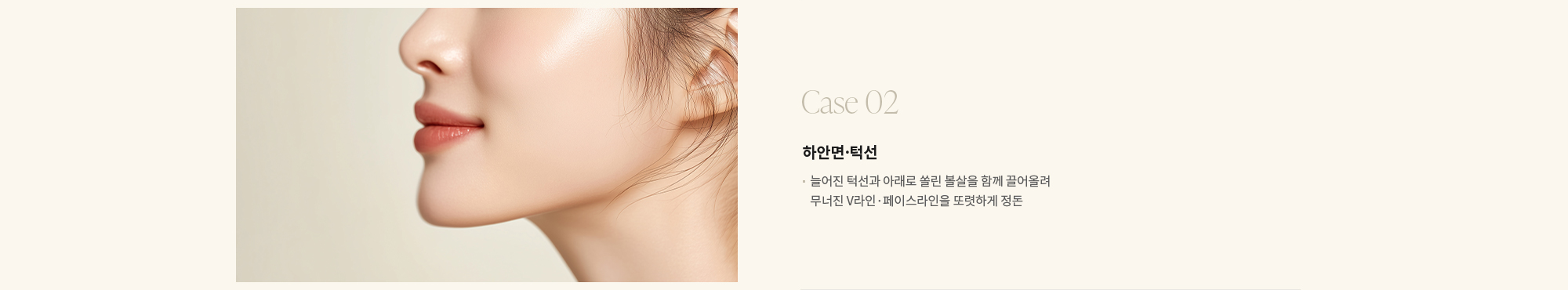 [Case 02] 하안면·턱선 : 늘어진 턱선과 아래로 쏠린 볼살을 함께 끌어올려 무너진 V라인·페이스라인을 또렷하게 정돈