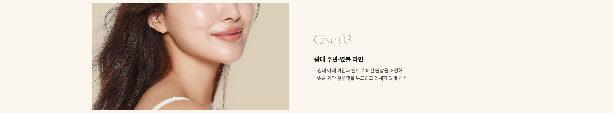 [Case 03] 광대 주변·옆볼 라인 : 광대 아래 꺼짐과 옆으로 퍼진 볼살을 조정해 얼굴 외곽 실루엣을 부드럽고 입체감 있게 개선