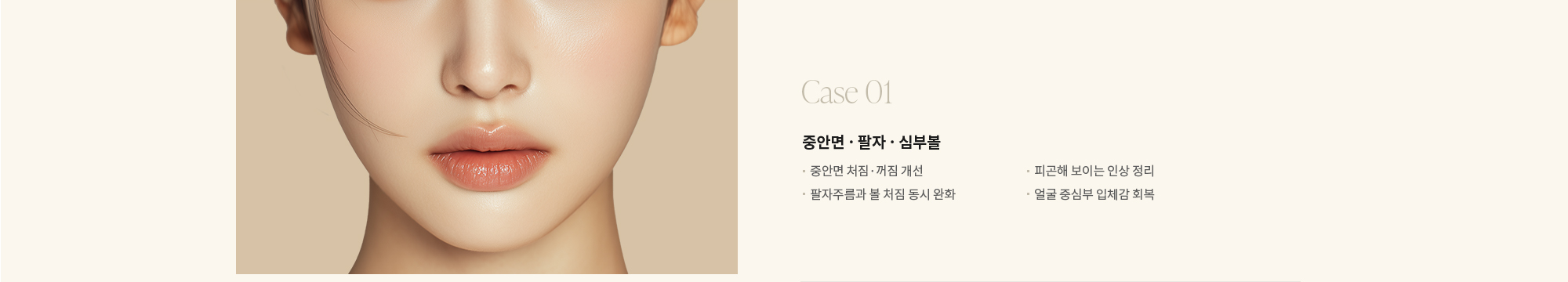 [Case 01] 중안면 · 팔자 · 심부볼 : - 중안면 처짐·꺼짐 개선 - 팔자주름과 볼 처짐 동시 완화 - 피곤해 보이는 인상 정리 - 얼굴 중심부 입체감 회복 