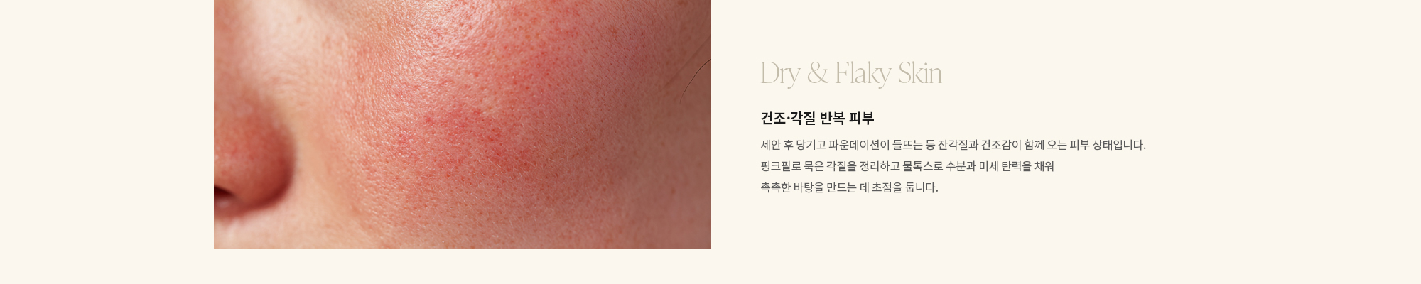 [Dry & Flaky Skin] 건조·각질 반복 피부 : 세안 후 당기고 파운데이션이 들뜨는 등 잔각질과 건조감이 함께 오는 피부 상태입니다. 핑크필로 묵은 각질을 정리하고 물톡스로 수분과 미세 탄력을 채워 촉촉한 바탕을 만드는 데 초점을 둡니다.