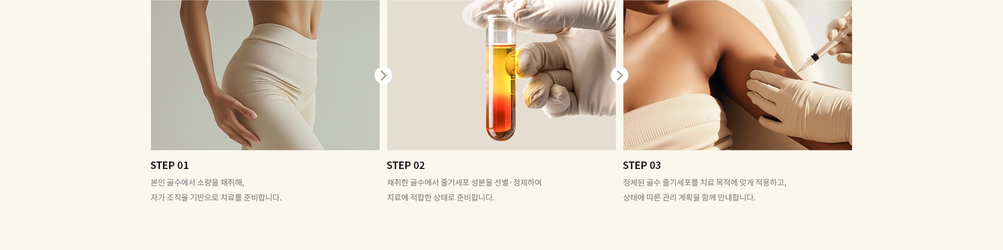 [STEP 01] 본인 골수에서 소량을 채취해,  자가 조직을 기반으로 치료를 준비합니다. [STEP 02] 채취한 골수에서 줄기세포 성분을 선별·정제하여 치료에 적합한 상태로 준비합니다. [STEP 03] 정제된 골수 줄기세포를 치료 목적에 맞게 적용하고, 상태에 따른 관리 계획을 함께 안내합니다.