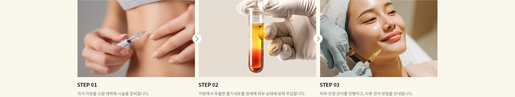 [STEP 01] 자가 지방을 소량 채취해 시술을 준비합니다. [STEP 02] 지방에서 추출한 줄기세포를 정제해 피부 상태에 맞춰 주입합니다. [STEP 03] 피부 진정 관리를 진행하고, 이후 관리 방법을 안내합니다.